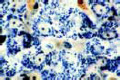 Mitochondria slide in thin sec. of kidney or liver.