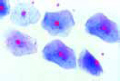 Squamous epithelium slide, isolated cells