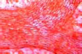 Endothelium slide, endothelial cells of small blood vessels