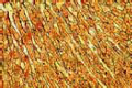 Reticular fibres slide, human spleen