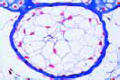Vesicular tissue slide, cellular connective tissue