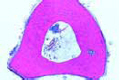 Compact bone, t.s.