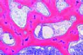 Cancellous slide (spongy) bone