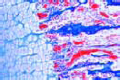 Bone development slide, intracartilaginous ossification