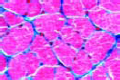 Striated (skeletal) muscle t.s.