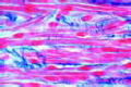 Smooth (involuntary) muscle slide, l.s.
