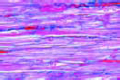 Smooth (involuntary) muscle slide, l.s. and t.s.
