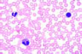 Human blood smear slide, Giemsa stain