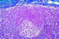 Lymph node of cat slide