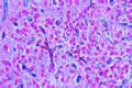 Pineal body slide (Epiphysis slide) of cow or pig