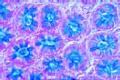 Colon slide, t.s. stained with muci-carmine