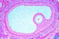 Ovary, sec. selected to show Cumulus oophorus