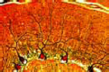 Cerebellum slide, t.s. Golgi’s silver method