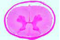 Spinal cord slide, pig