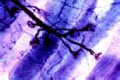 Motor nerve endings slide, muscle stained with gold chloride