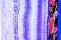 Retina of pig, thin sec