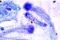 Dicyema slide, simple animal with body and sexual cells
