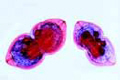 Mussel embryology slide, Glochidia larva