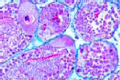 Helix pomatia slide, hermaphrodite gland