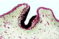 Patella slide, cup-shell. simple eye