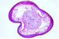 Ascaris megalocephala slide
