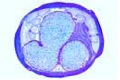 Ascaris lumbricoides, roundworm of man