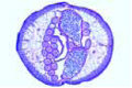 Ascaris lumbricoides slide