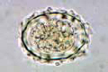 Ascaris lumbricoides slide, ova in faeces