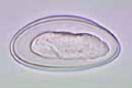 Enterobius vermicularis, ova from faeces