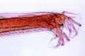 Ancylostoma duodenale, hookworm of man