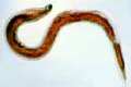 Ancylostoma duodenale slide, adult female