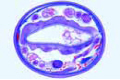 Ancylostoma duodenale slide