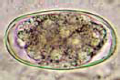 Ancylostoma duodenale, ova