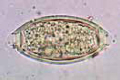 Trichuris trichiura slide, ova in faeces