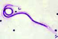 Microfilaria slide, smear from bird lung with parasites