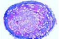 Onchocerca volvulus slide, sec. through host tissue