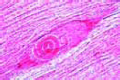 Trichinella spiralis slide