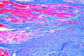 Cardiac callosity slide