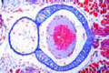 Scyllium, vertebral column with spinal cord and notochord