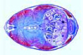 Fresh water fish, abdominal region