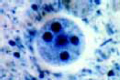 Entamoeba histolytica slide, showing cysts