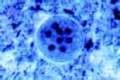 Entamoeba coli slide, smear showing cysts
