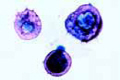Arcella slide, shelled amoeba w.m.
