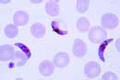 Plasmodium falciparum slide