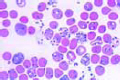 Plasmodium berghei slide, blood smear from experimentally infected mouse