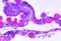 Plasmodium slide, section through infected mosquito stomach