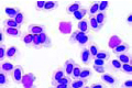 Plasmodium cathemerium slide, avian malaria