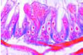 Nosema apis slide, honey bee dysentery