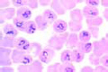 Babesia canis slide, blood smear