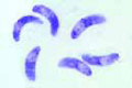 Toxoplasma gondii slide, causing toxoplasmosis slide